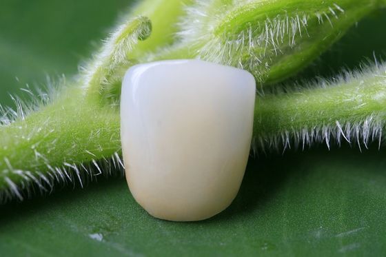 大きい適性完全な陶磁器のBiocompatible EMAXの歯科王冠