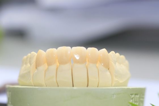 歯科実験室のための大きいBiocompatibilityの完全な輪郭のジルコニアの歯科王冠
