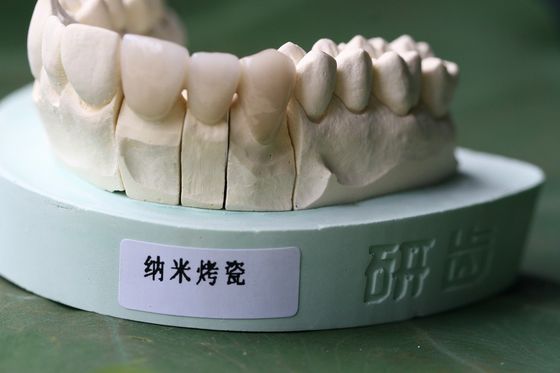 ISO13485よいBiocompatibility PFMの非貴重な歯科王冠