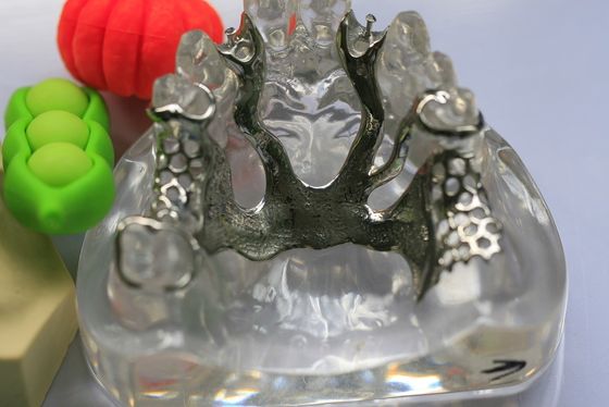 Cr Coの部分的な総義歯の金属フレームワーク