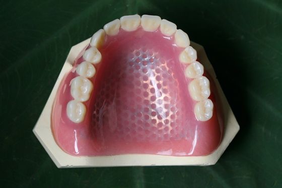 金属の骨組部分的な総義歯の金属フレームワークを印刷する3D