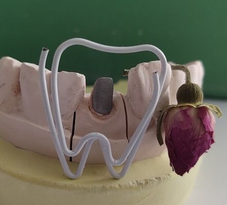 Endodontic処置の後の金属の歯科ポストそして中心