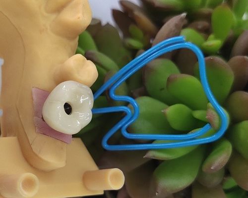 単一の歯のTrushine OSSETEMの歯科インプラントの据え付け品のレベル