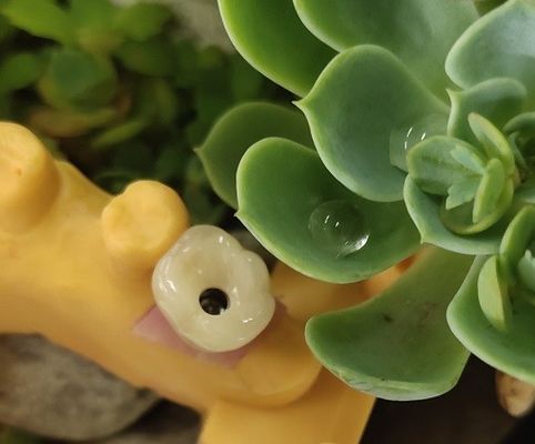大きいBiocompatibility ANKYLOSの歯科インプラントの支えられた王冠