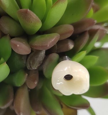 ねじによって保たれる据え付け品のレベルの歯科インプラントは戴冠する