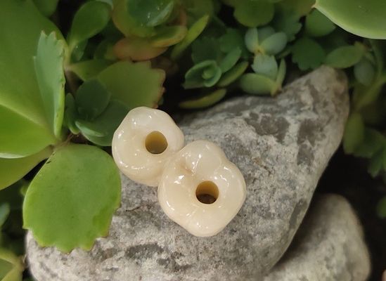 ねじによって保たれる据え付け品のレベルの歯科インプラントは戴冠する