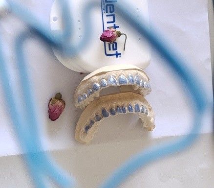 歯を白くするための注文ISO13485漂白の皿