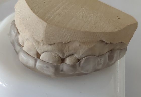 Estheticsは歯くいしばることのためのアーチの口金を下げる