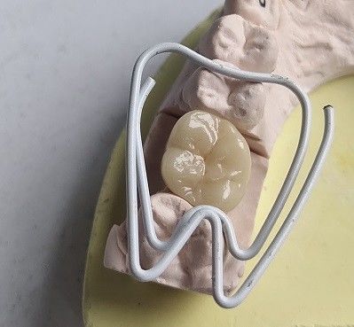 磁器の立方ジルコニアの歯