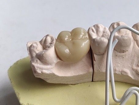 磁器の立方ジルコニアの歯