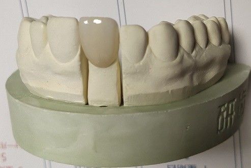 ジルコニアはCAD CAMの製粉によって歯科3D印刷物を妨げる