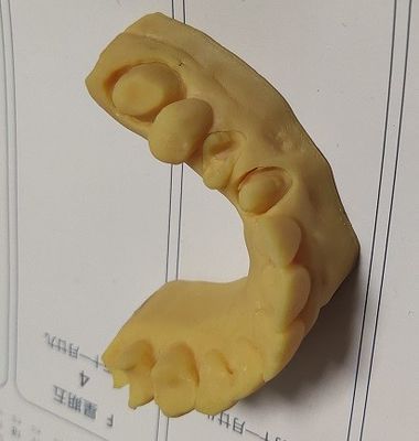 高精度ISO13485 Trushineの歯科3D印刷物モデル