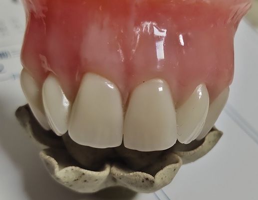 Estheticsの完全な総義歯の冷たい治されたアクリルの部分的な総義歯