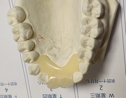 Trushineの柔らかい伸縮性があるナイロン見えない総義歯