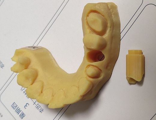 高精度ISO13485 Trushineの歯科3D印刷物モデル