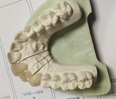 CADの技術ISO13485の暫時王冠
