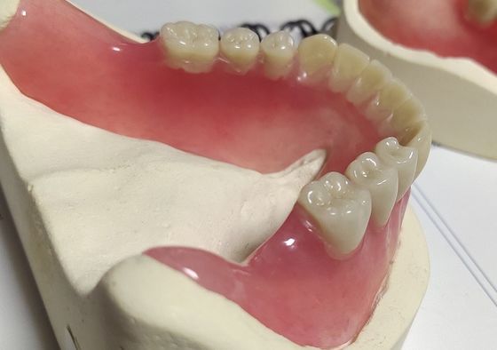 Estheticsの完全な総義歯の冷たい治されたアクリルの部分的な総義歯
