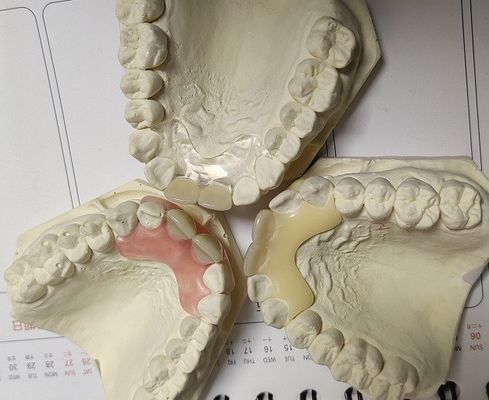 Valplastの一時的で柔らかく、伸縮性がある見えない総義歯