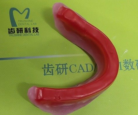 かみ傷登録歯科ワックスの縁