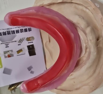 かみ傷登録歯科ワックスの縁