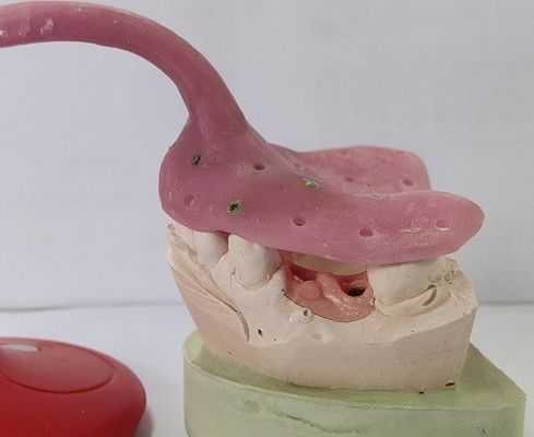 注文の総義歯の印象の皿