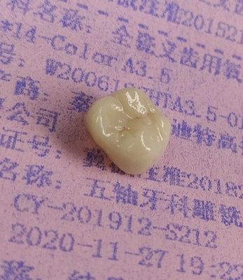 ジルコニアはCAD CAMの製粉によって歯科3D印刷物を妨げる