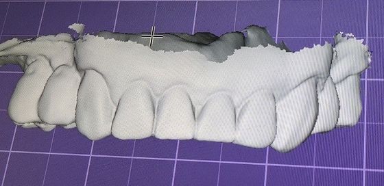 歯の上の3Dデジタルの嘲笑他の歯科プロダクト
