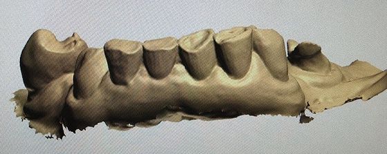 歯の上の3Dデジタルの嘲笑他の歯科プロダクト