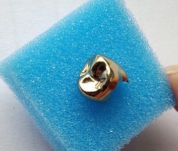 高く気高い金の完全な金属の歯科王冠