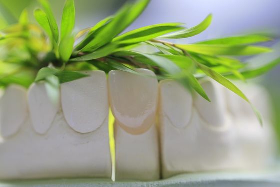 前方の歯のための自然で永久的なガラスの陶磁器の歯科王冠