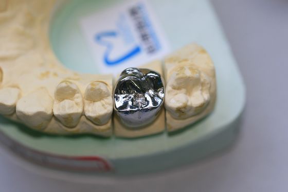 完全な鋳造物の母材は歯科王冠を合金にする