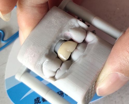 実験室PFMの歯科王冠3Dの印刷橋歯科王冠