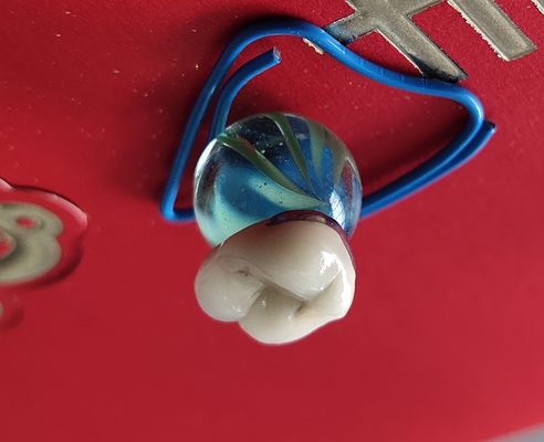 歯科実験室プロダクトCAD CAM PFM王冠の磁器は金属をかぶせるために溶けた