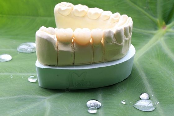 歯科実験室のための大きいBiocompatibilityの完全な輪郭のジルコニアの歯科王冠