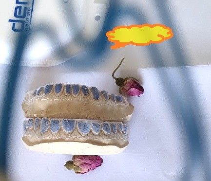 歯を白くするための注文ISO13485漂白の皿