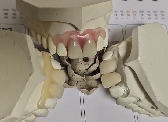 快適な適合ISO13485 RPDの柔らかく見えない総義歯