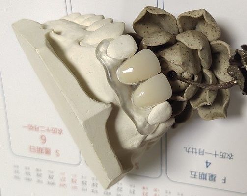 Trushineの柔らかい伸縮性があるナイロン見えない総義歯